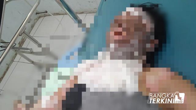 Berawal Cekcok Mulut, di Bangka Tengah seorang Suami Tega Bakar Istri. (Ilham/Bangka Terkini)