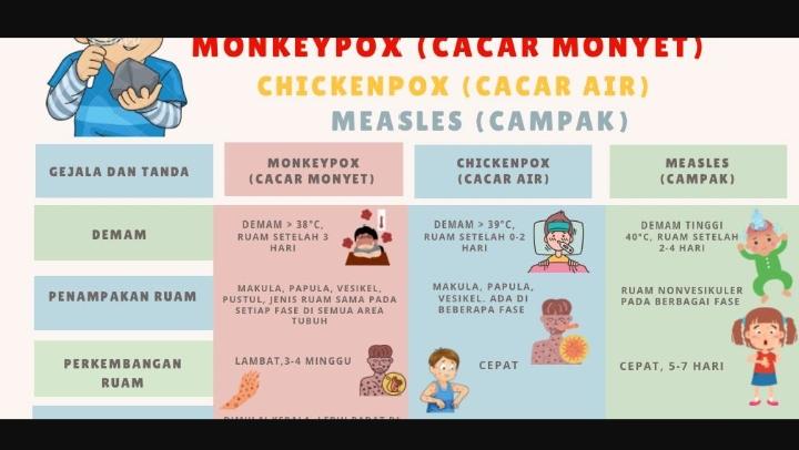 Dinkes Pangkalpinang Imbau Masyarakat Waspada Cacar Monyet